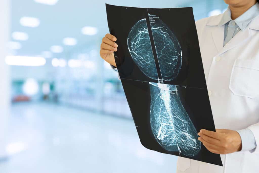 Volpara Volpara highlights impact of AI-driven breast health solutions - Pulse+IT